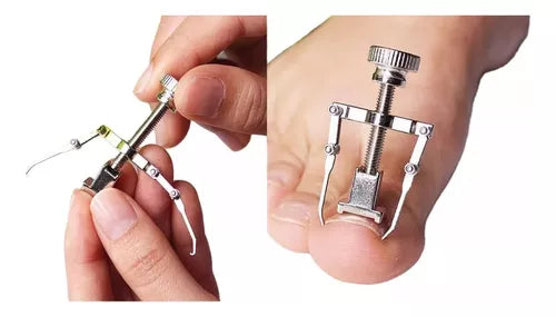 Herramienta para uñas enterradas